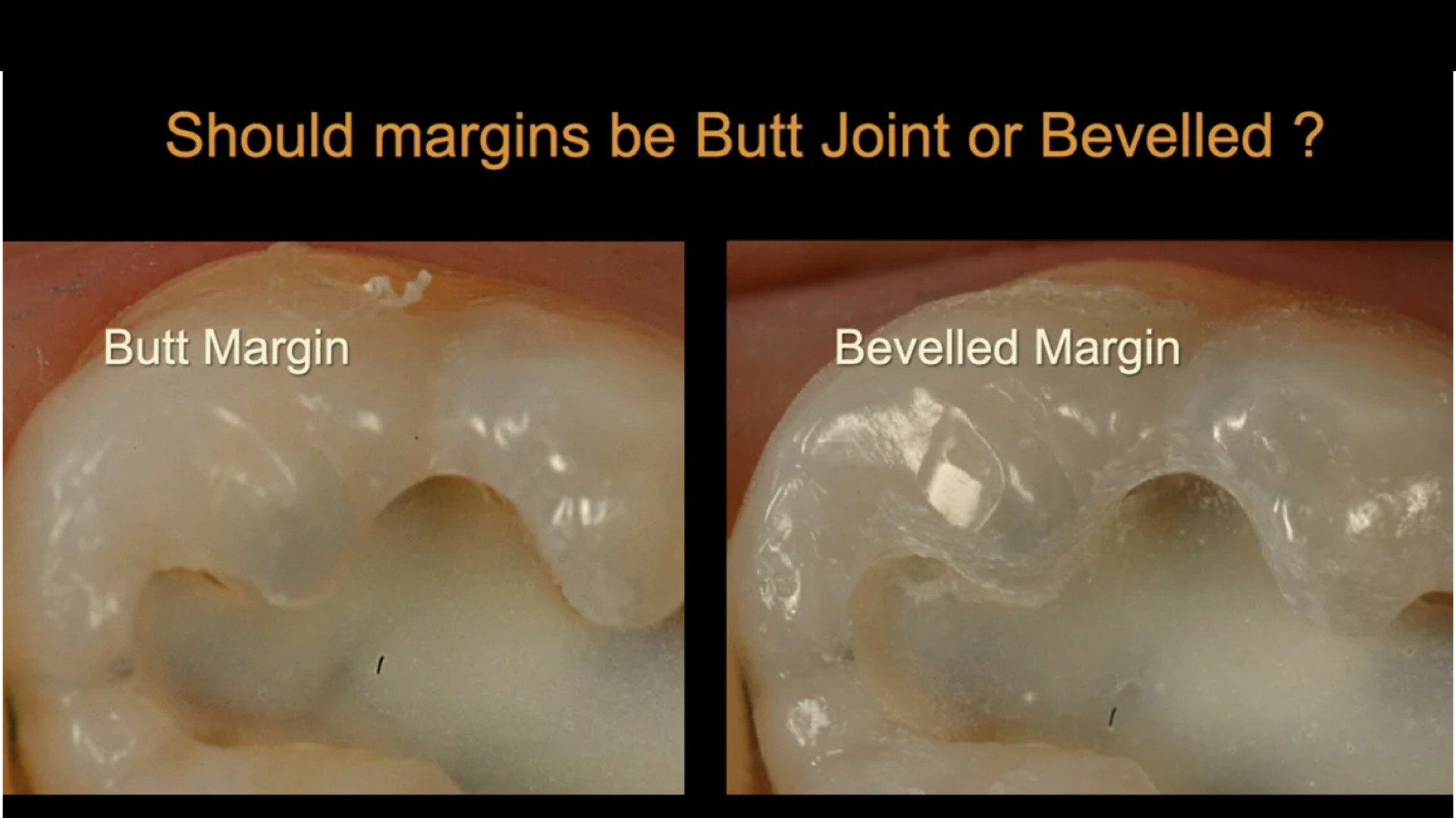 How to finish margins to avoid white lines