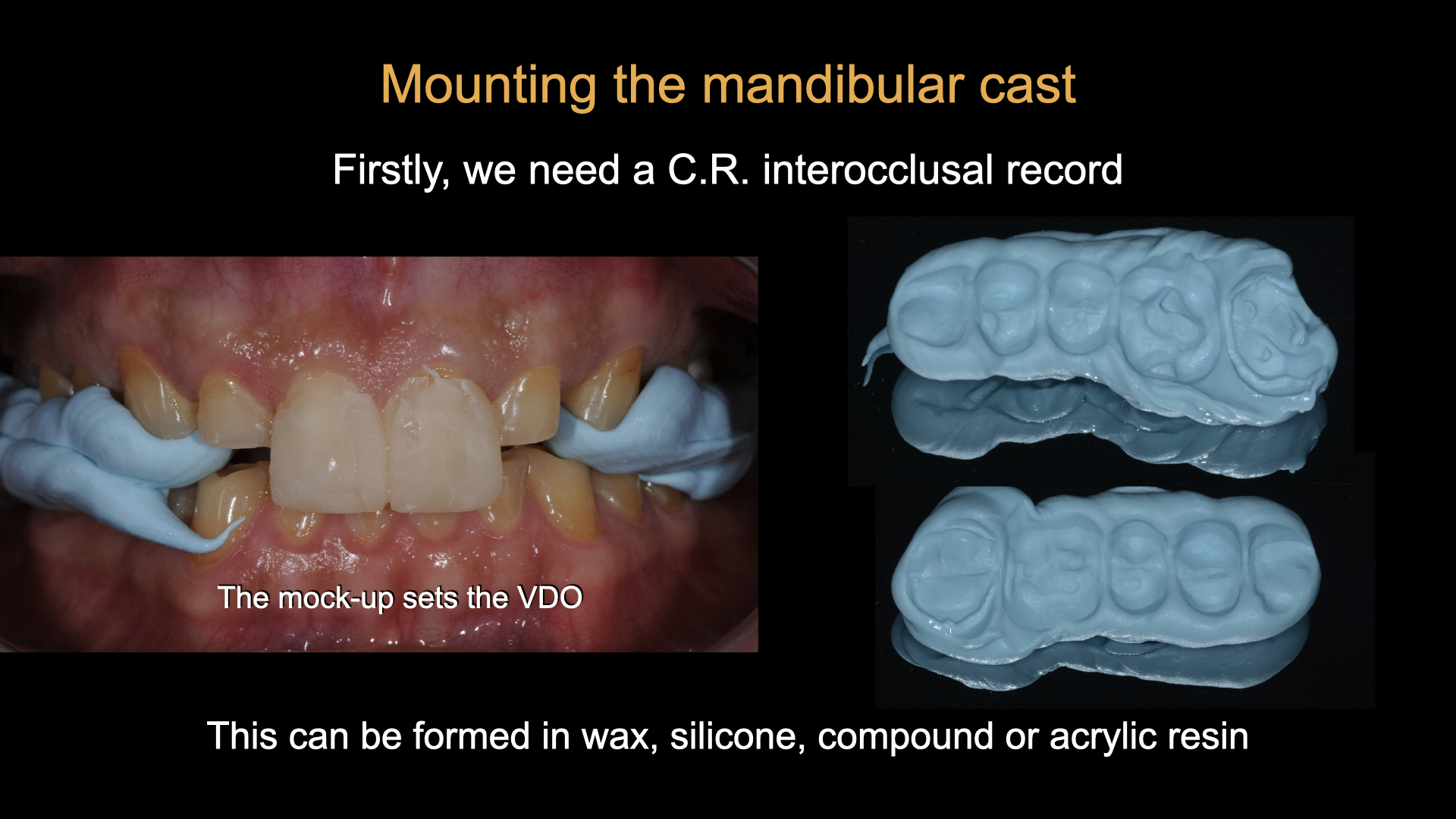 A Day of Occlusion - Updated Program !