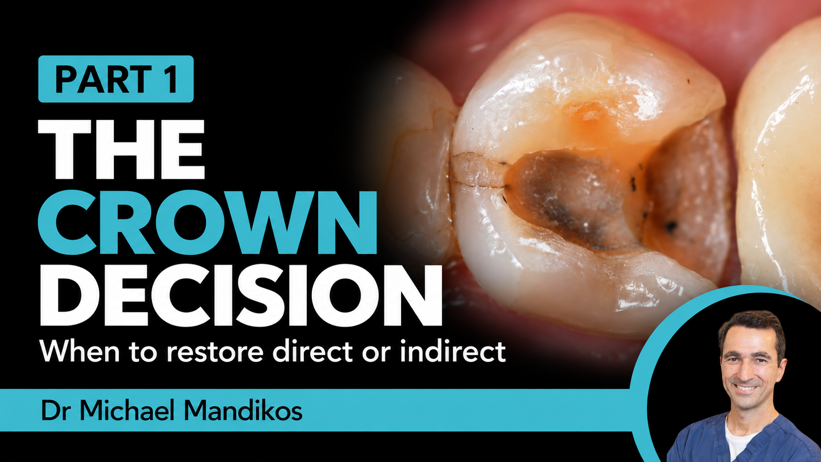 The Crown Decision - Part 1 - When to crown or restore