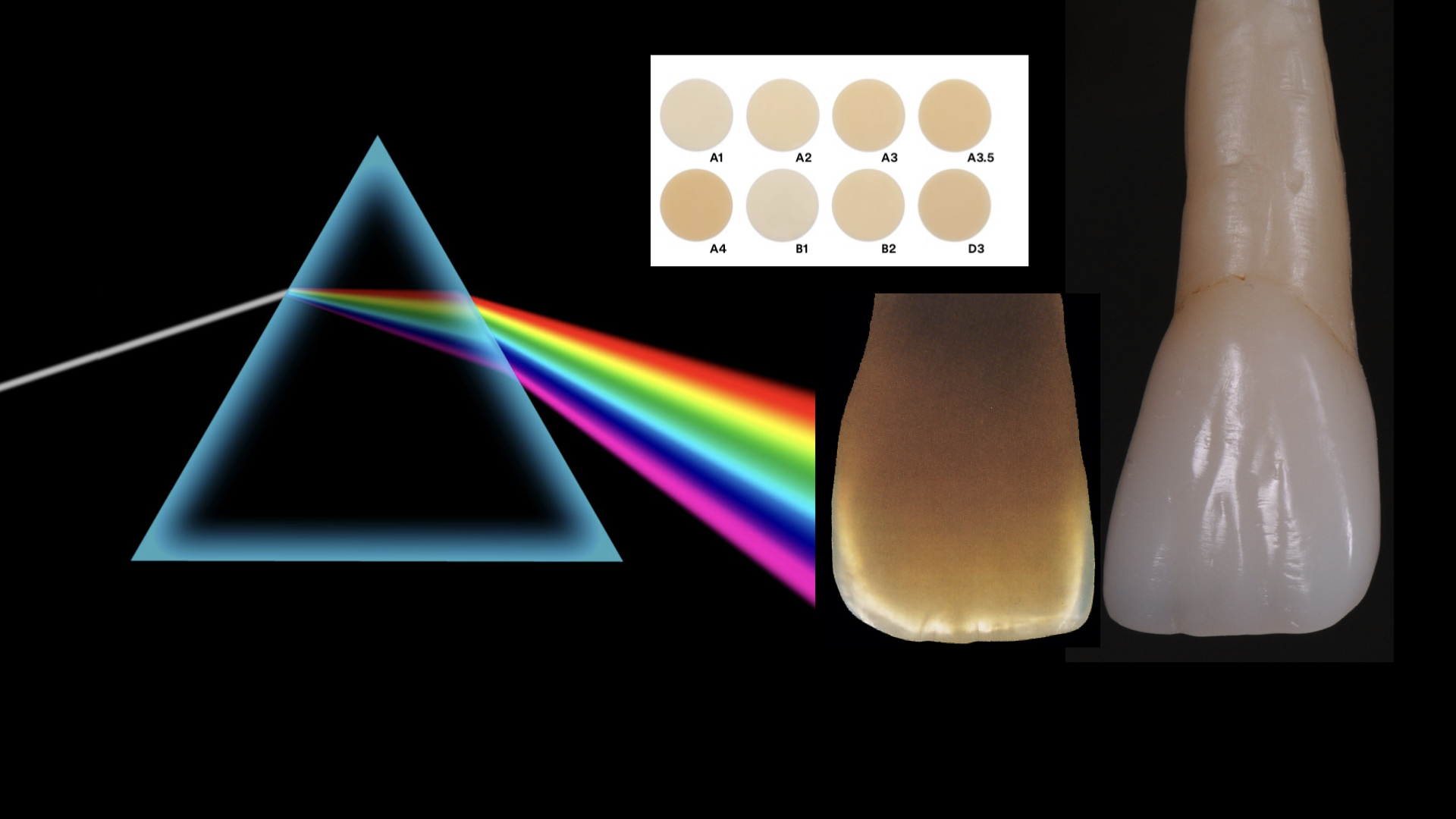 Mastering Composite Shade Selection - the Science of Biomimetic Colours