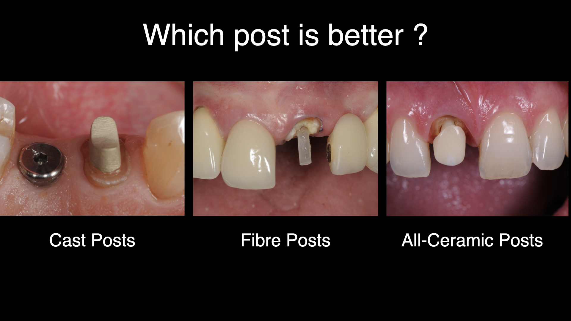 Which Post is Best ? Preview