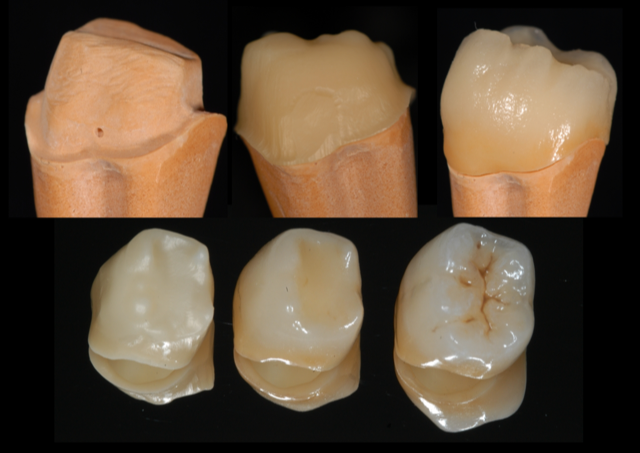 Zirconia – confirming truths and busting myths