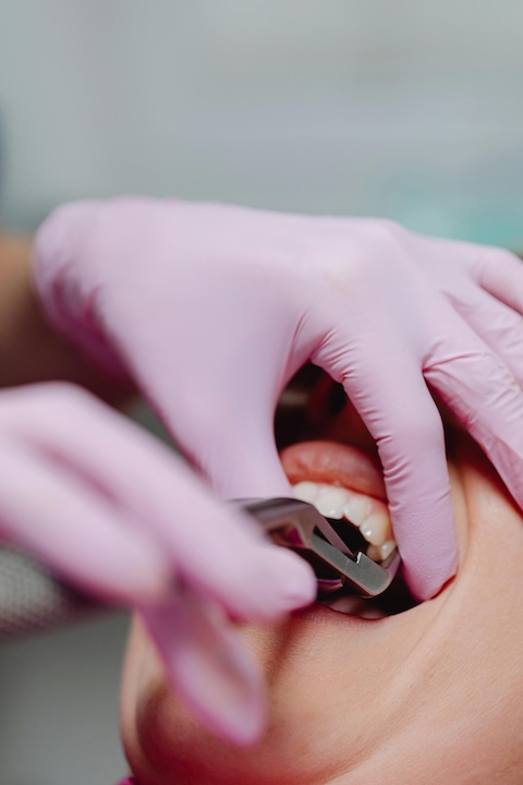 Understanding Occlusion and Splints